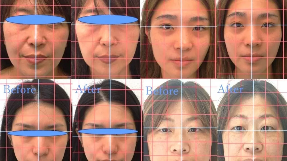 1回の施術でここまで変化しますよ♪